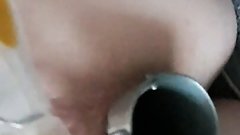 Anal speculum in Julie