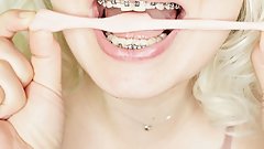 BRACES fetish: ASMR video of eating MUKBANG.
